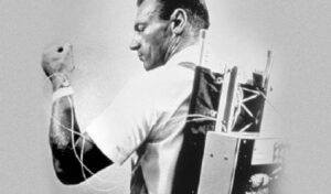 1963 – The first prototype of a ‘pump’ | Diabetes Australia
