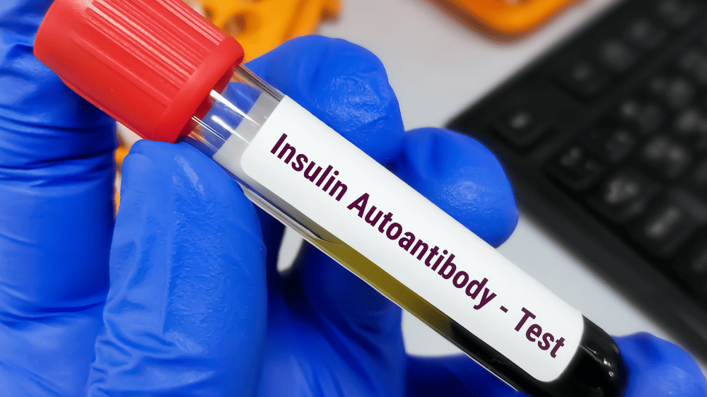 Insulin Autoantibody - test tube