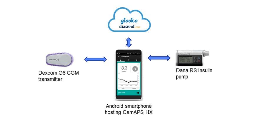 The Cambridge artificial pancreas set up