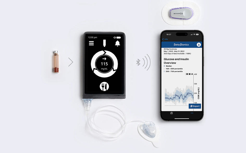 Bionic pancreas permitted by FDA