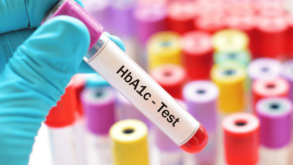 HbA1c test