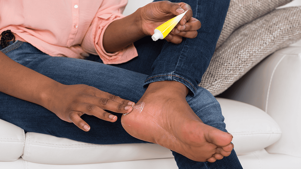 woman rubbing cream into heel