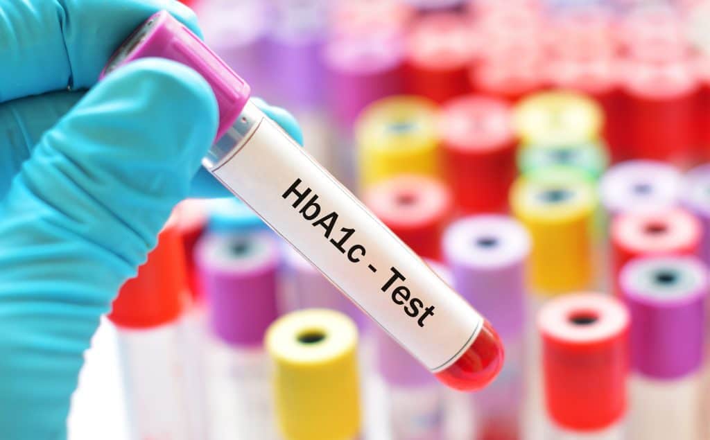 Blood sample for HbA1c test