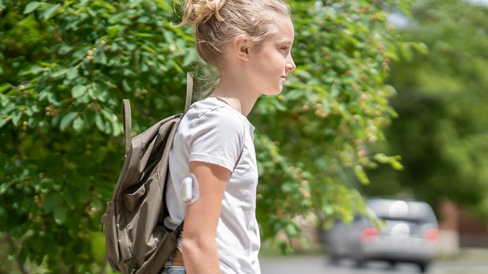 Teenage girl walking with tubeless insulin patch pump on her arm